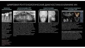 Что использовать для планирования в Залог успеха